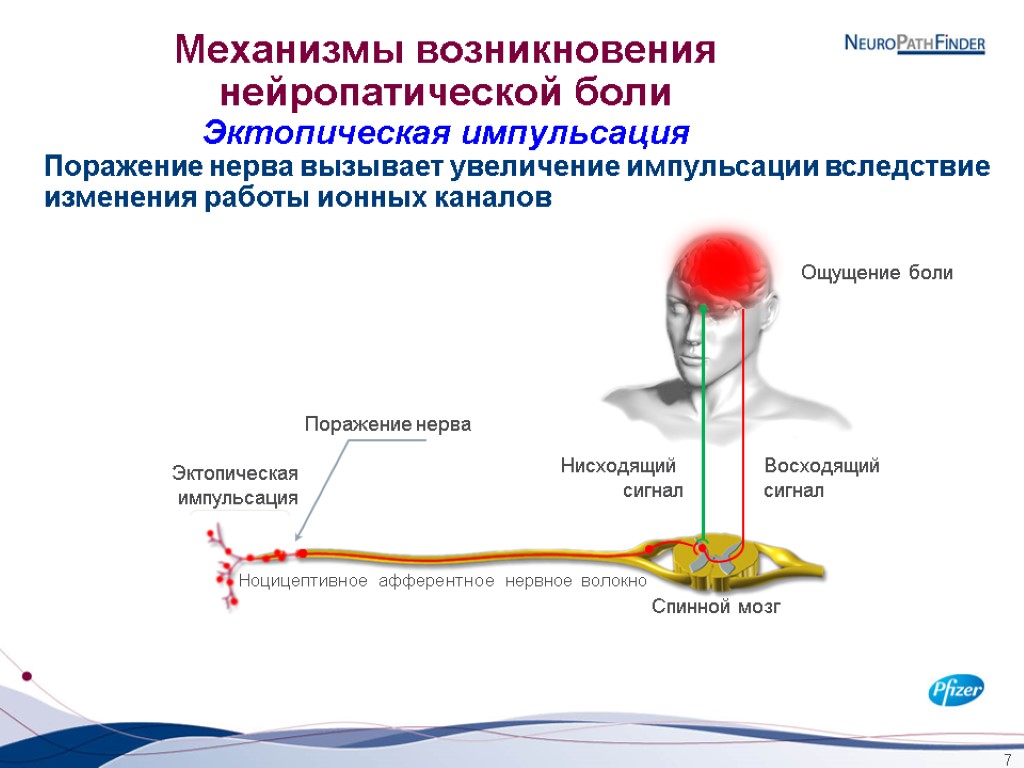 7 Ноцицептивное афферентное нервное волокно Спинной мозг Восходящий сигнал Нисходящий сигнал Ощущение боли Механизмы